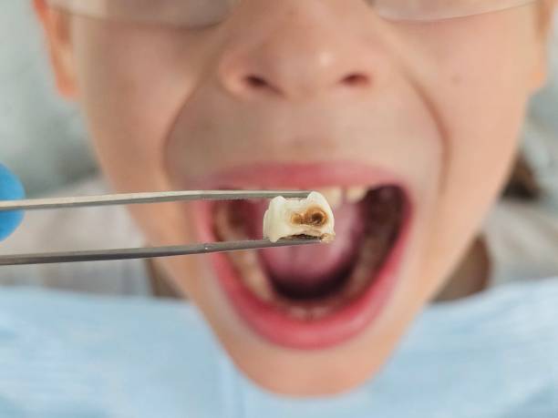 Best Pediatric Emergency Dentist in Ontario, CA